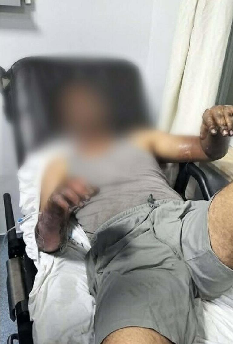 Oto tamirhanesinde patlama; 2 işçi yaralandı