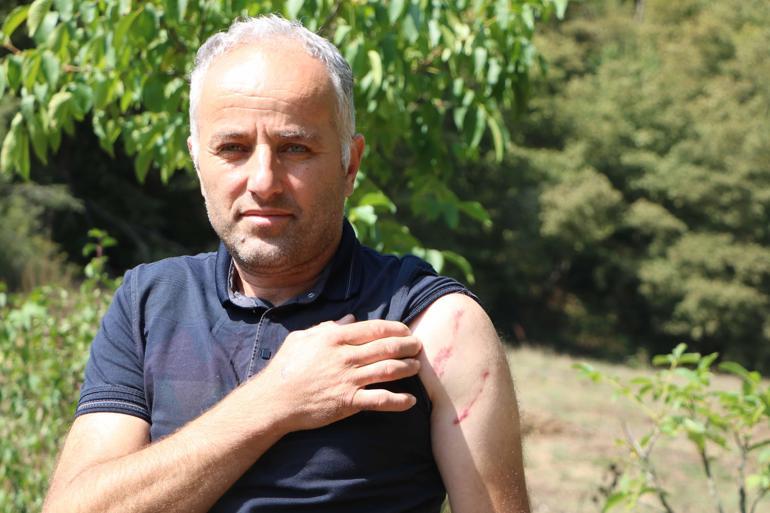 Babası gibi ayı saldırısına uğradı; parmağı koptu