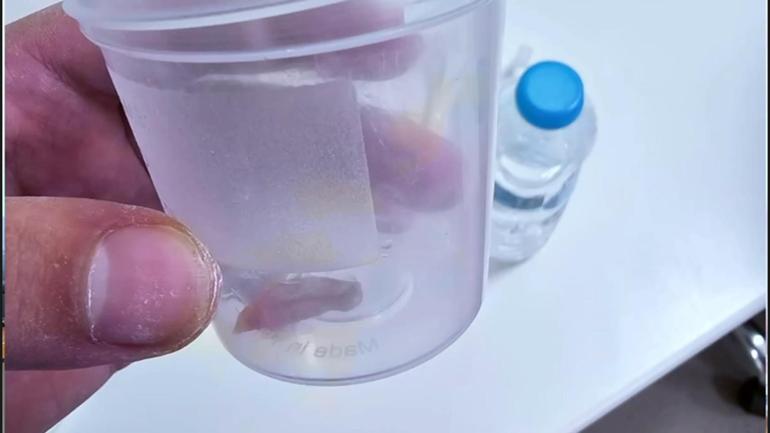 1,5 yıllık öksürüğün nedeni, kabak çekirdeği çıktı