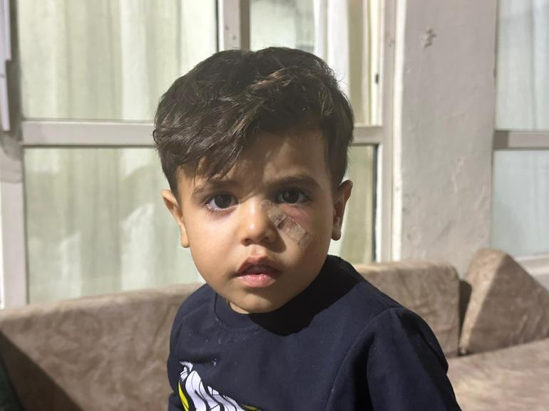Yorgun mermi, 4 yaşındaki çocuğun gözünün altına isabet etti