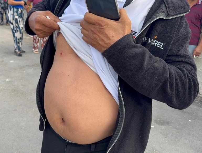 Husumetli ailelerin silahlı kavgası; 2 yaralı