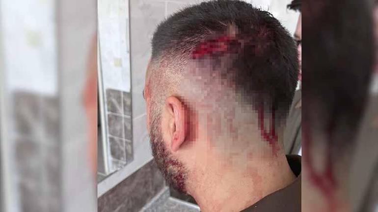 Öğretmene okulda demir sopalı saldırı