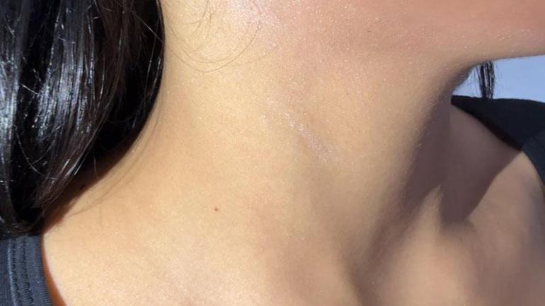 Taksim’de korku evinde darbedilip elektroşok uygulanan kadın: Hayatımı mahvetti, karanlıkta duramıyorum