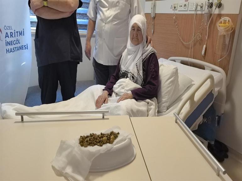 Bursada 77 yaşındaki kadının safra kesesinden 213 tane taş çıkarıldı