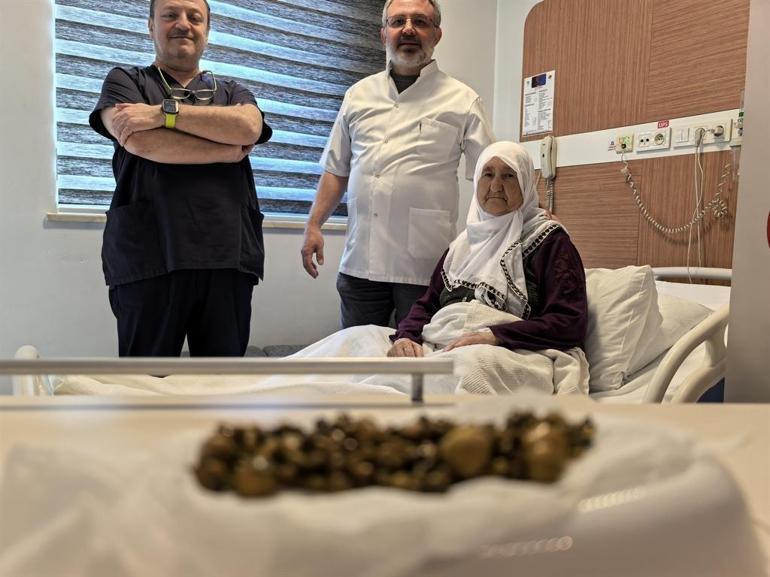 Bursada 77 yaşındaki kadının safra kesesinden 213 tane taş çıkarıldı