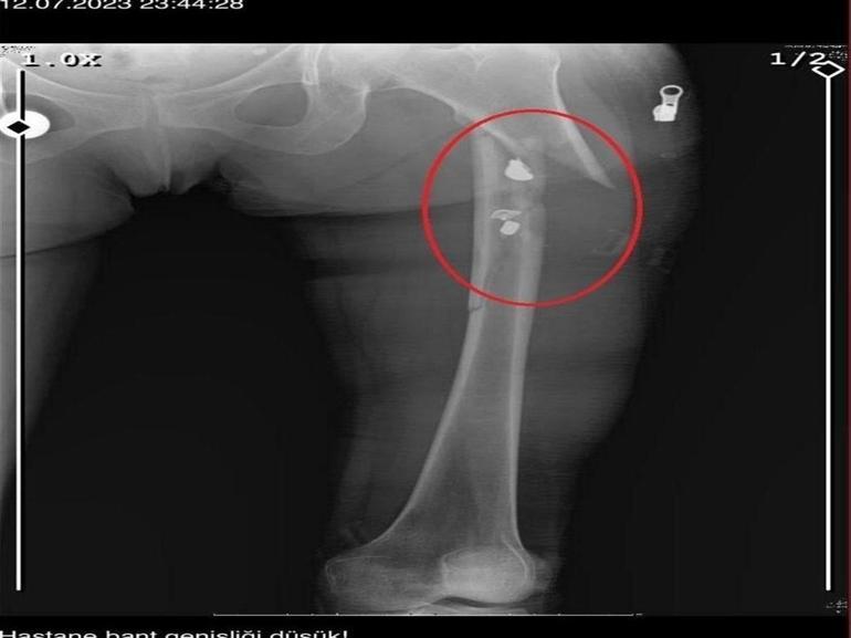 Arkadaşını öldürüp, yaraladığı sevgilisini 21 gün boyunca evinde tutan sanığa müebbet ile 70 yıl hapis