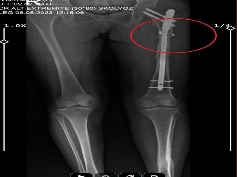 Arkadaşını öldürüp, yaraladığı sevgilisini 21 gün boyunca evinde tutan sanığa müebbet ile 70 yıl hapis