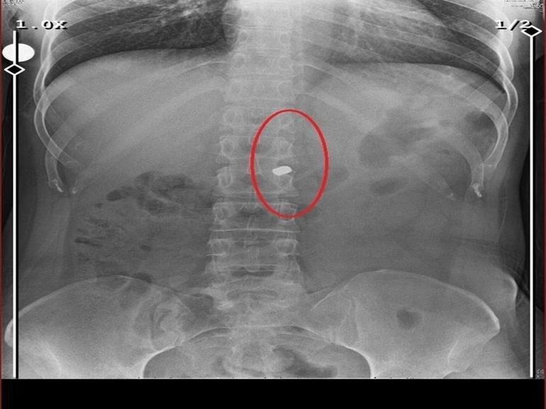 Arkadaşını öldürüp, yaraladığı sevgilisini 21 gün boyunca evinde tutan sanığa müebbet ile 70 yıl hapis
