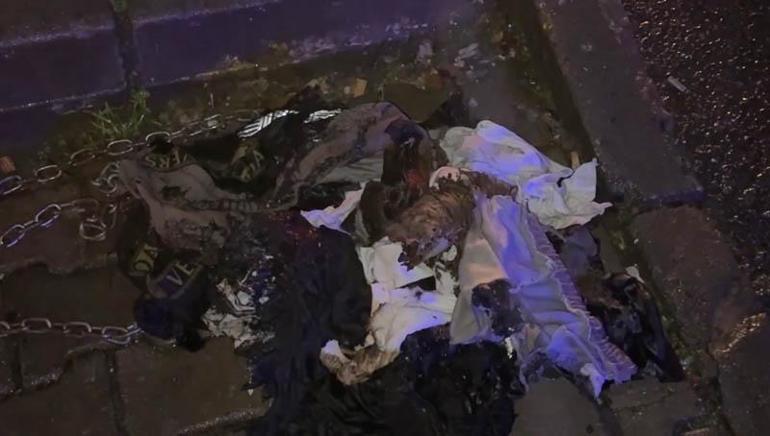 Kağıthane’de kuafördeki yangında tüm vücudu yanan 14 yaşındaki Enginin tedavisi tamamlandı: Kapı sıkışınca çıkamadım yandım