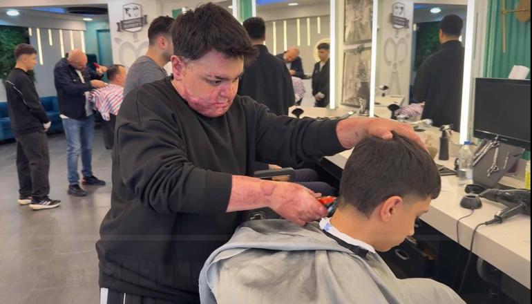 Kağıthane’de kuafördeki yangında vücudu yanan 15 yaşındaki Engin: Mücadeleyi kesinlikle bırakmasınlar ben yılmadım