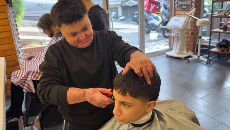 Kağıthane’de kuafördeki yangında vücudu yanan 15 yaşındaki Engin: Mücadeleyi kesinlikle bırakmasınlar ben yılmadım