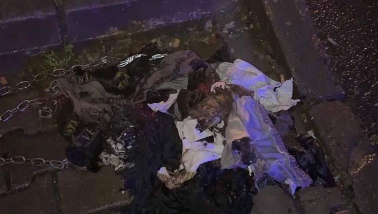 Kağıthane’de kuafördeki yangında vücudu yanan 15 yaşındaki Engin: Mücadeleyi kesinlikle bırakmasınlar ben yılmadım