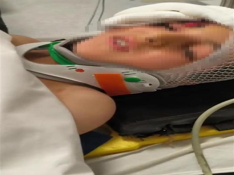 Vücudunun bir kısmı toprağa gömülü bulunan Amir, okulunu ve arkadaşlarını özlemiş