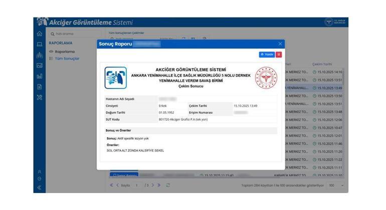 Sağlık Bakanlığı, Akciğer Görüntüleme Sistemini hayata geçirdi