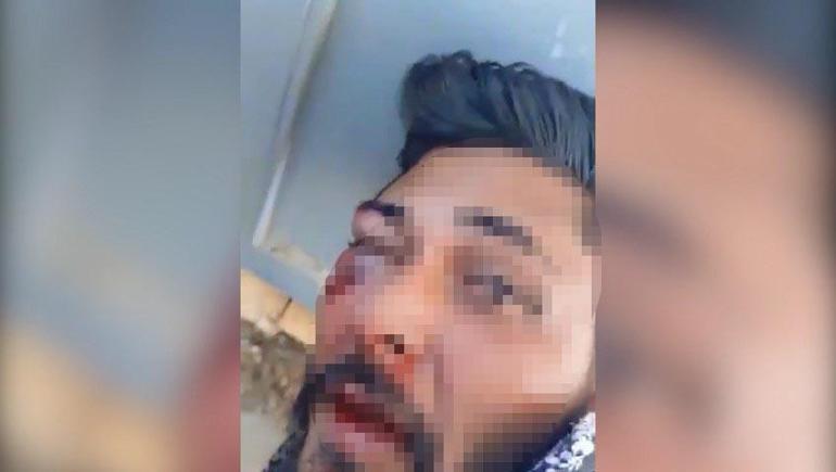 Taciz şüphelisini dövüp, jandarmaya teslim ettiler