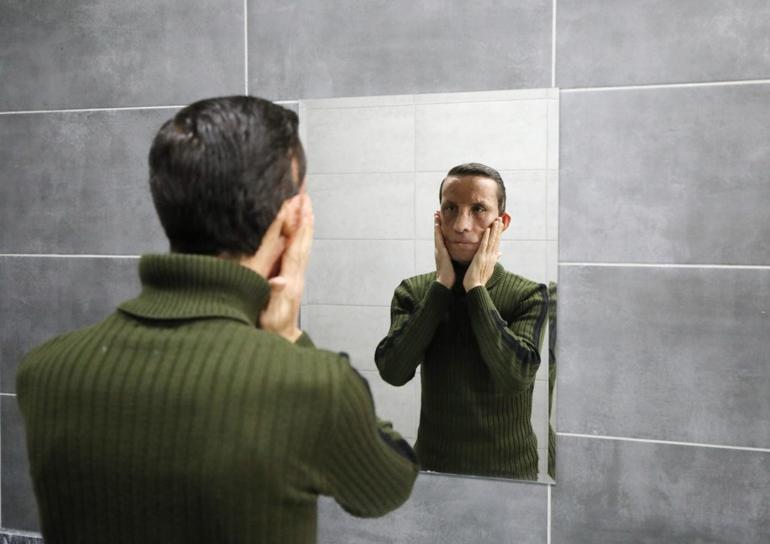 İlk yüz nakilli Uğur Acar, hayata 14 yıldır başka bir yüzle bakıyor