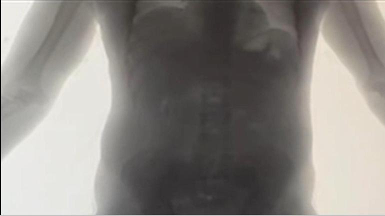 2025’te İstanbul Havalimanı’nda ‘yutucu’ kuryelerden 29,7 kilo uyuşturucu ele geçirildi