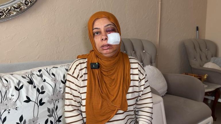 Elektrikli bisikleti ile kapağı kırık rögara düştü; yüzüne 14 dikiş atıldı