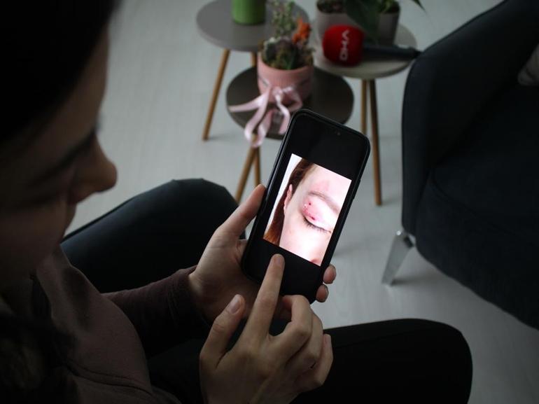 Gözünde hasar iddiasıyla yaptığı şikayet reddedildi; Uzmanına gidin uyarısı yaptı