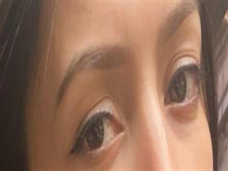 Gözünde hasar iddiasıyla yaptığı şikayet reddedildi; Uzmanına gidin uyarısı yaptı