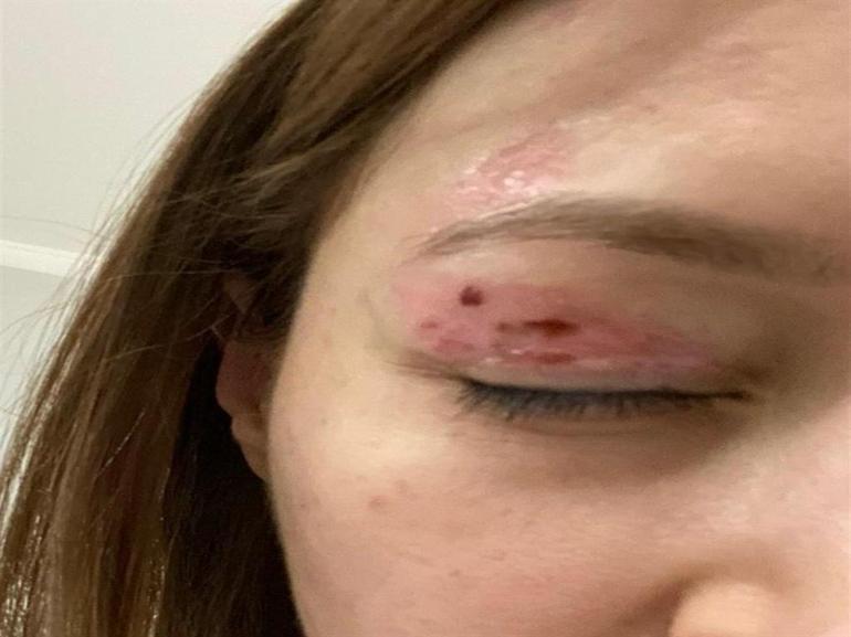 Gözünde hasar iddiasıyla yaptığı şikayet reddedildi; Uzmanına gidin uyarısı yaptı