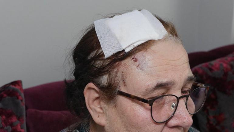 Esenyurtta bir yıldır tehdit ettiği çifti sopayla darbetti