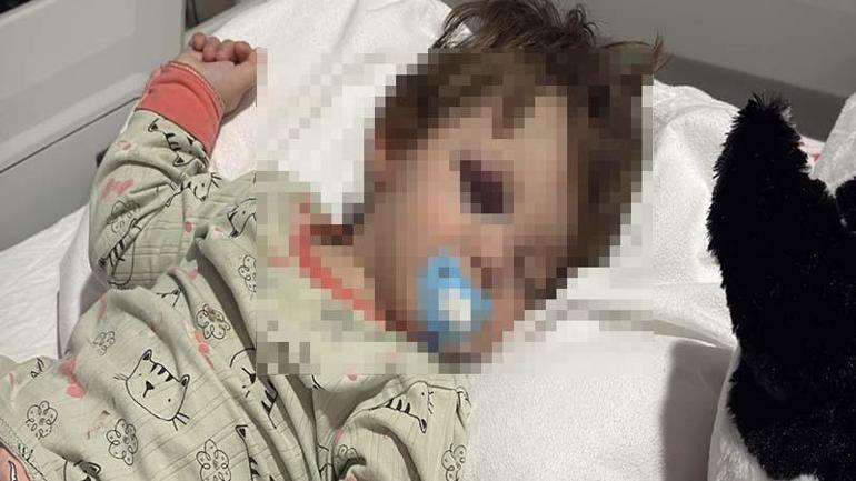 Kucağında bebeği ile darbedilen babanın oğlu, sokakta başına atılan taşla yaralandı