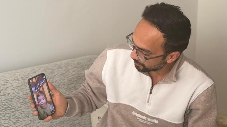 Pitbull saldırısında yaralanan kardeşlerin babası: Oğlumun yüzündeki yara kalıcı olacak gibi