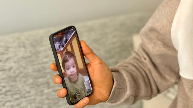 Pitbull saldırısında yaralanan kardeşlerin babası: Oğlumun yüzündeki yara kalıcı olacak gibi