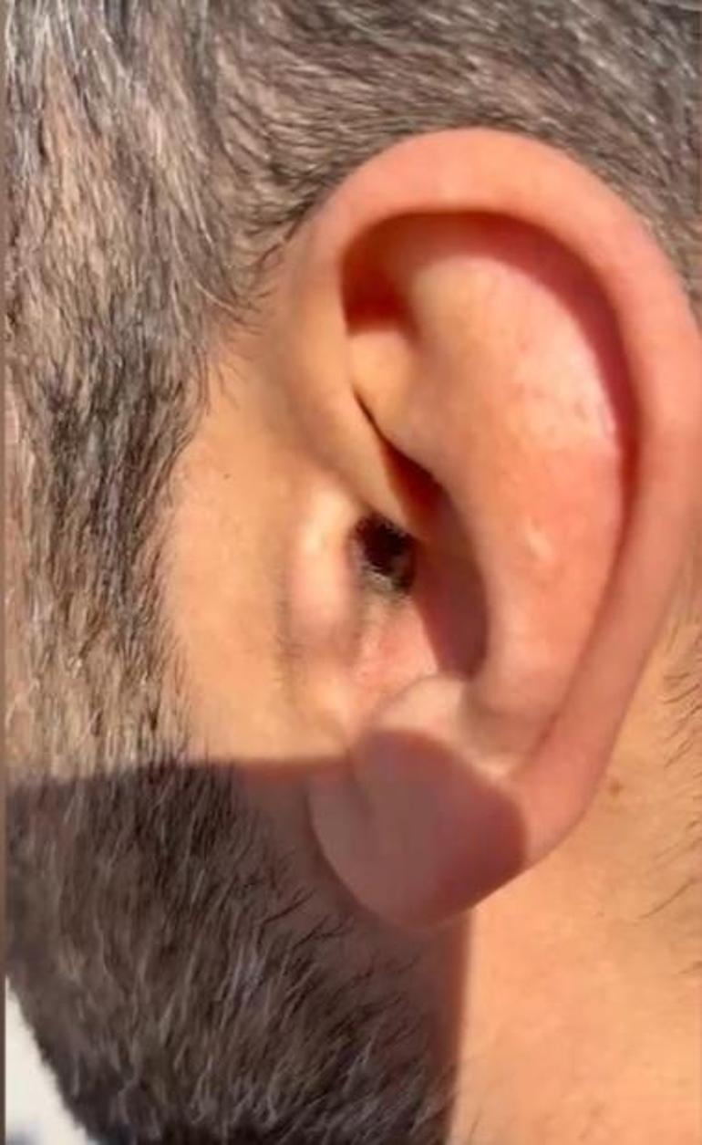 Kulağına gizlediği uyuşturucuyla yakalandı