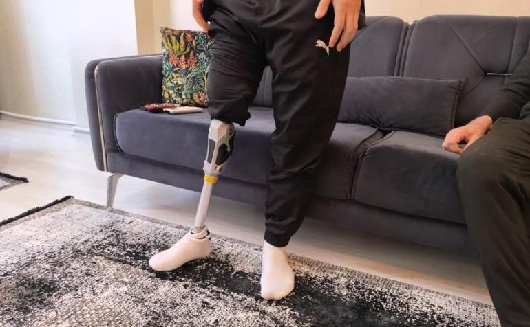Akın motosiklet kazasında bacağını kaybetti, hayırseverler 450 bin liralık protezle yürümesini sağladı