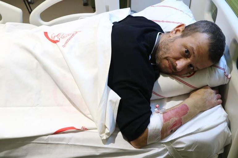 40 yıldır yanık hastalarına şifa oluyor