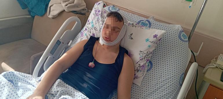 Lise öğrencilerinin darp davası: Çenesi nasıl kırıldı anlam veremedik