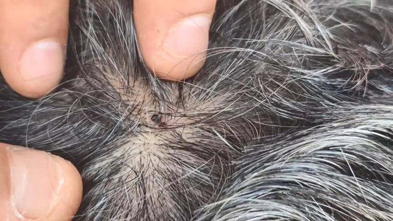 Zeytinburnunda anten tamiri için çatıya çıktı martıların saldırısına uğradı; Az kalsın çatıdan düşecektim
