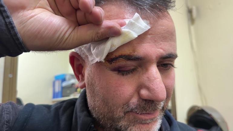 Yıkandı dedikleri çeki tahsil etmek isteyen grup, olumsuz cevap veren fırıncıyı darbetti