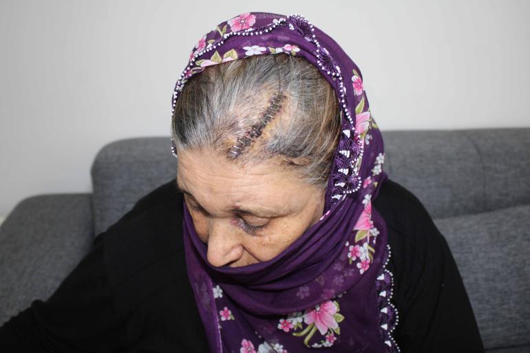 Engelli kızı için rampa isteyen kadına komşunun kürekli saldırısı kamerada; şüpheli tutuklandı