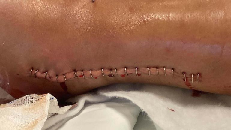 Boşandığı eşine ve oğluna otomobille çarptı, 20 yıl 6 ay hapis cezası aldı