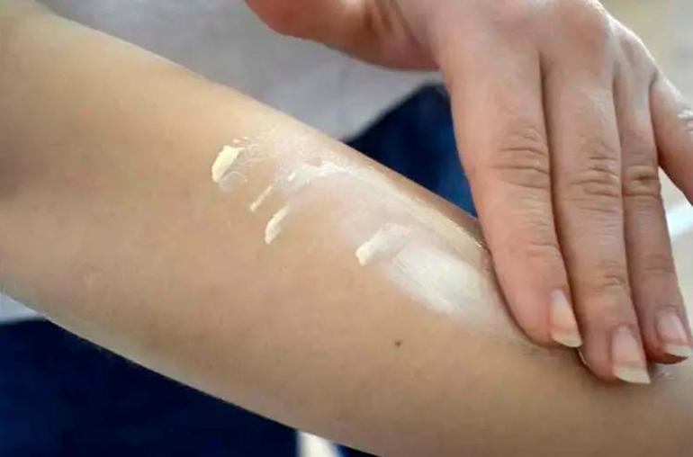 Uzmanlardan uyarı: Güneş kremi ve gözlük aksesuar değil, sağlık ihtiyacı