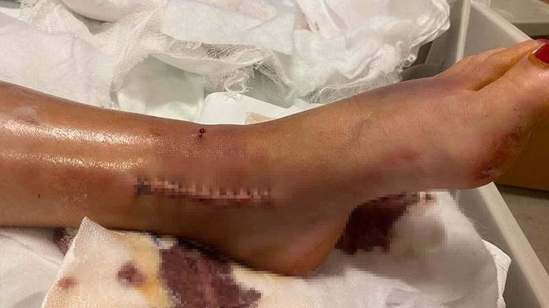 Eski eşi ve oğlunu aracıyla ezen sanığın davasında gerekçeli karar: Kast, öldürme suçuna temas ediyor