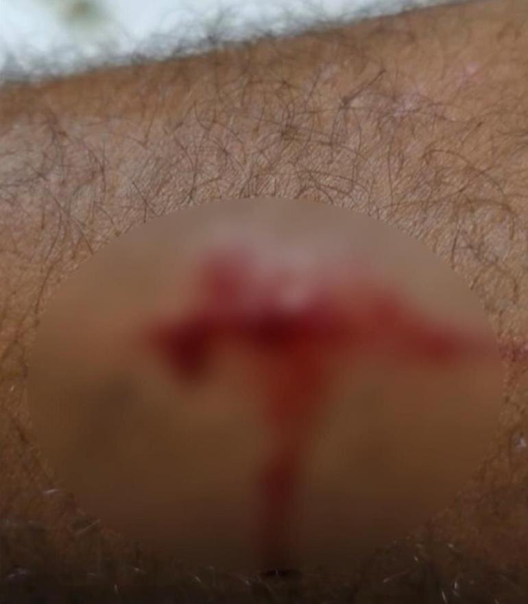 Karaköy’de Kanadalı turist takside önce gasp sonra bıçaklı saldırı iddiası; saldırı anları kamerada