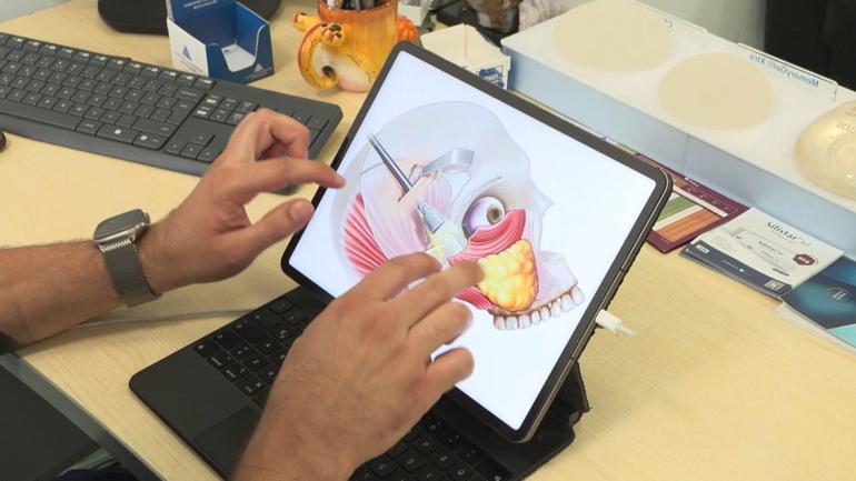 Endoskopik yüz germede kesi izi saçlı deri içerisinde kalıyor