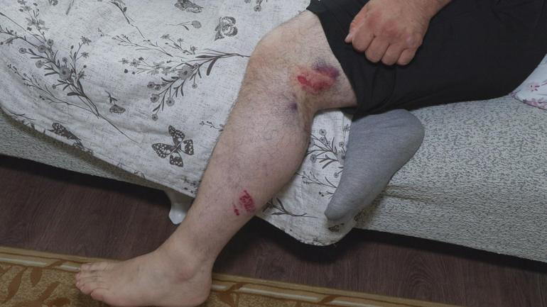 Başakşehirde kızıyla ekmek almaya giderken motosiklet çarptı: Ölebilirdim