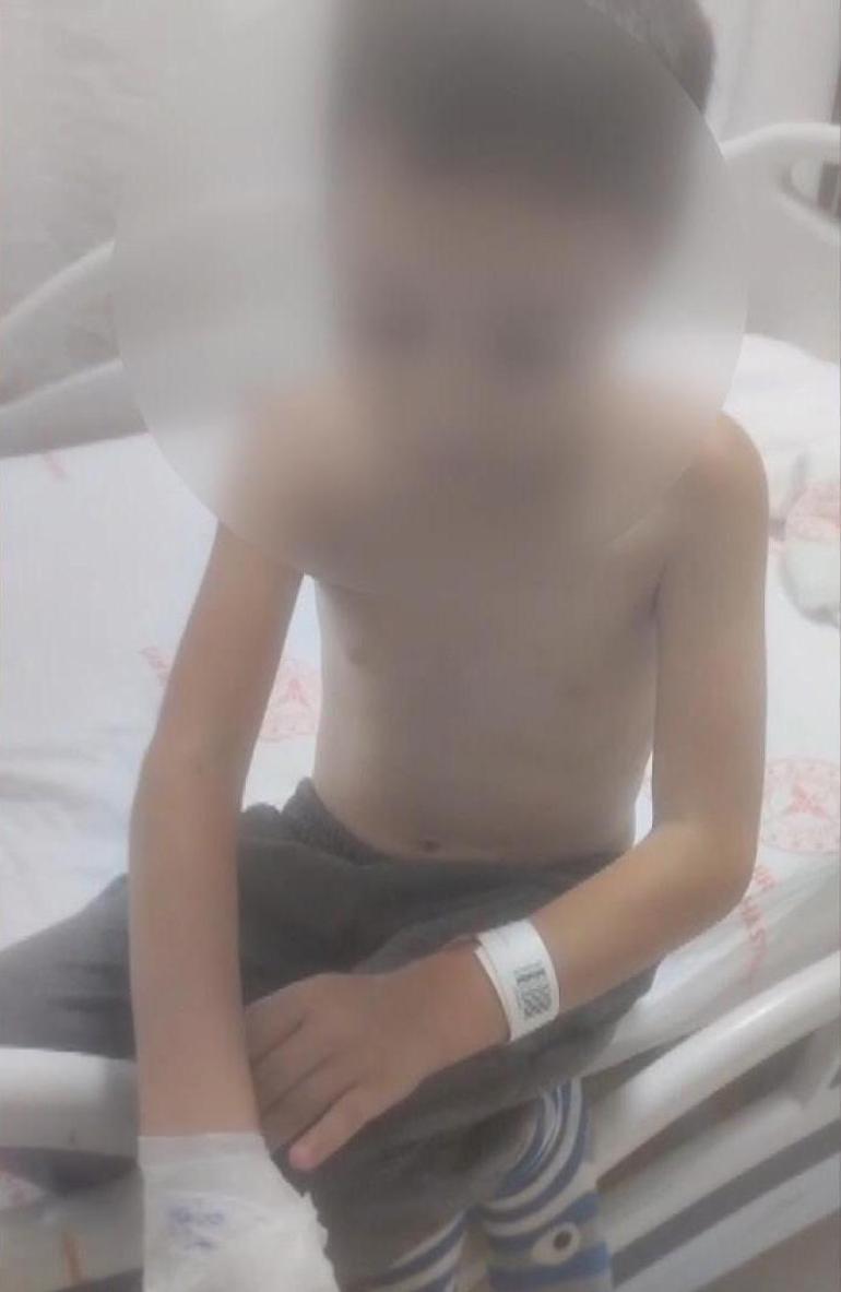 Arnavutköy’de arkadaşları tarafından kolonya dökülüp ateşe verilen 12 yaşındaki çocuk yaralandı