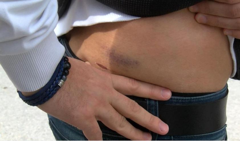 Pitbull saldırısından otomobilin üstüne çıkarak kurtulduğu anları anlattı